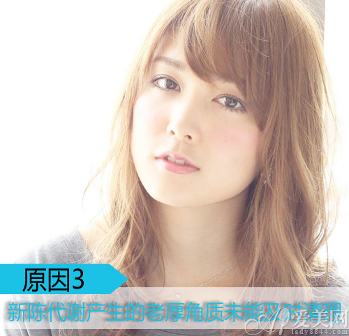  臉上起皮千萬別撕 溫和去角質(zhì)挽救缺水肌 