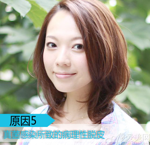  臉上起皮千萬別撕 溫和去角質(zhì)挽救缺水肌 