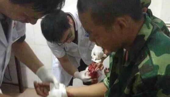 湖南軍訓教官與師生沖突致42傷