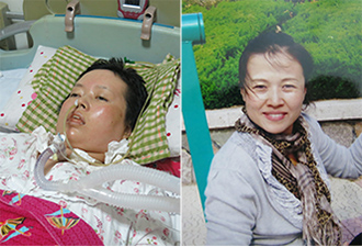 她是漸凍人 她曾經貌美如花