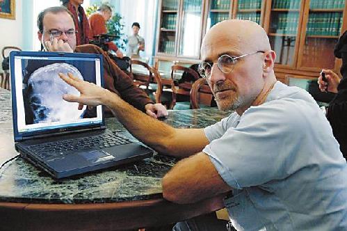 意大利醫(yī)生宣布2年內(nèi)進(jìn)行全球首例人頭移植(圖)