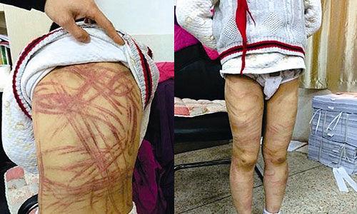 南京虐童案養(yǎng)母致歉：非?；诤薷械缴钌钭载?zé)