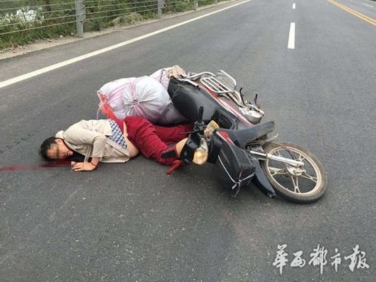 待产孕妇骑摩托车摔昏迷 医生剖腹取出8斤重男婴